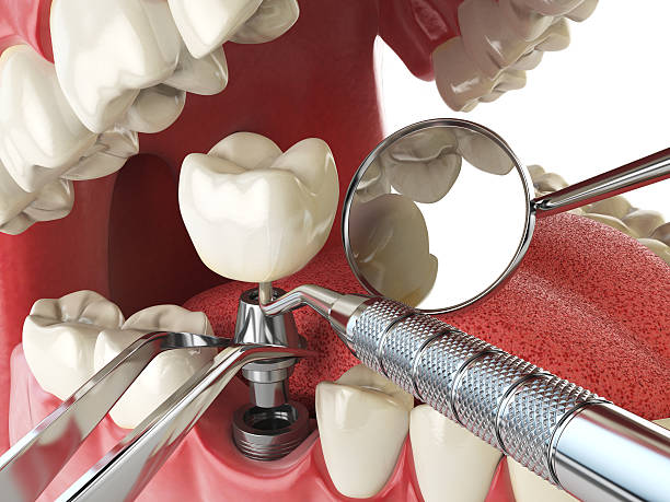 Best Urgent Tooth Repair  in , FL